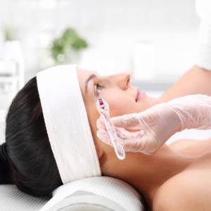 microneedling skin care treatment