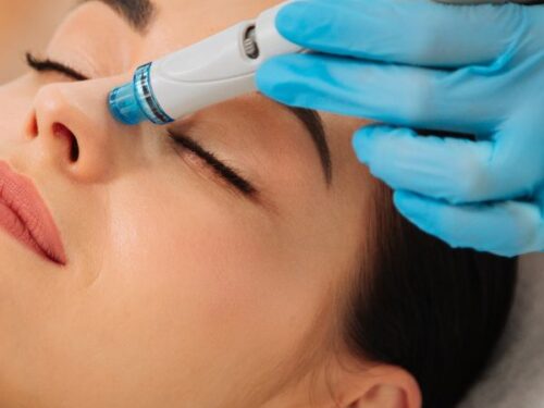 HydraFacial