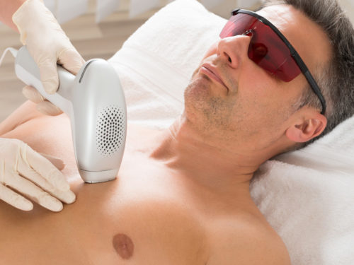 laser-hair-removal-mans-chest