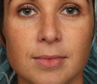 skin care after