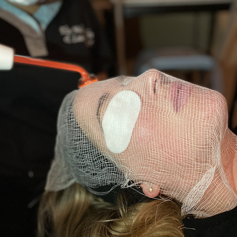 LED Light Therapy Facial Treatment