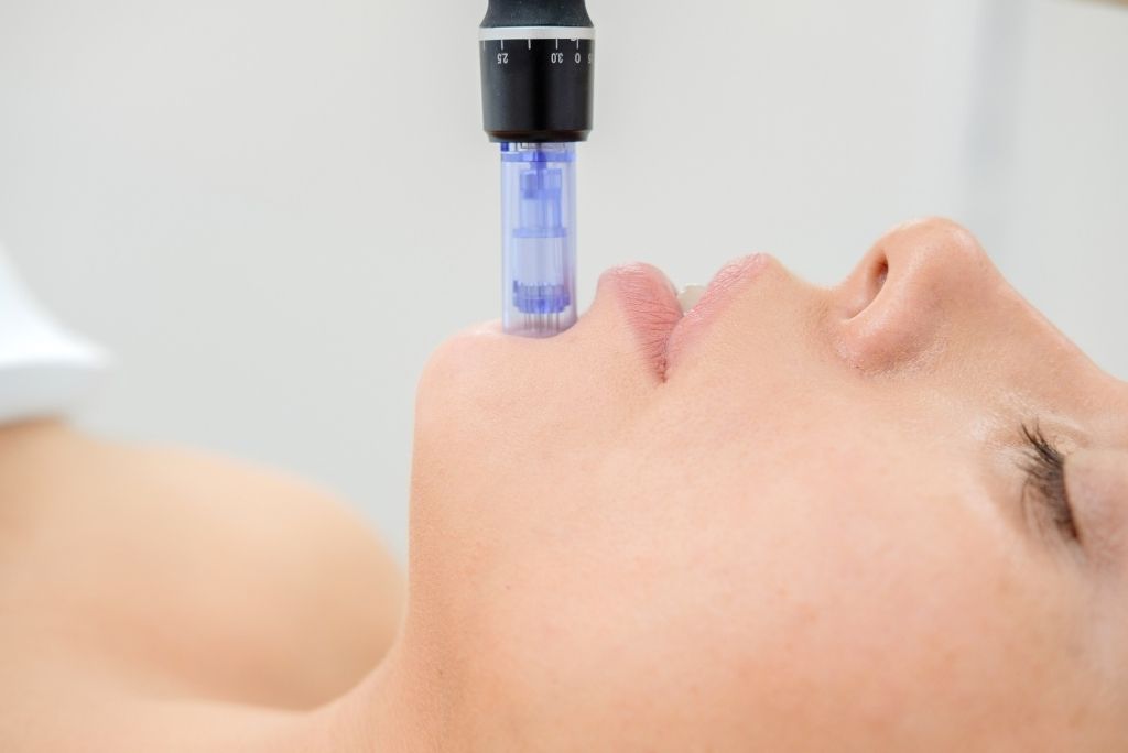 Microneedling Skin Care Treatment