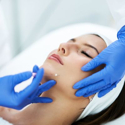 Untitled (400 × 400 px)-4 cosmetic medical treatments - PDO Thread Lift