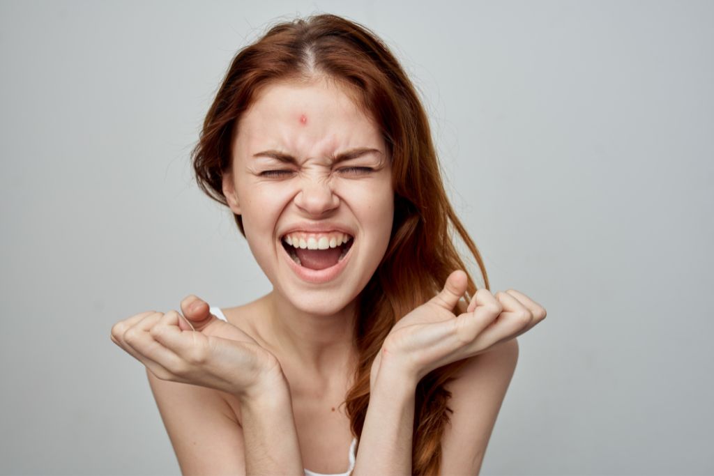 Teen Acne
